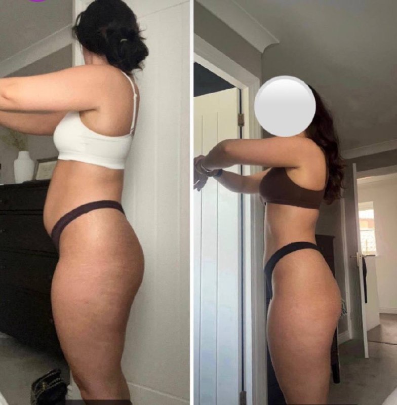Client transformation — side view